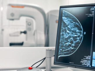 Mujer realizandose una mamografia en el mes de prevencion del cancer de mama
