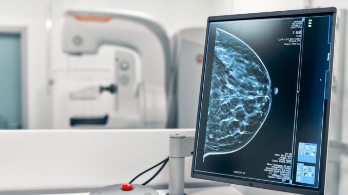 Mujer realizandose una mamografia en el mes de prevencion del cancer de mama